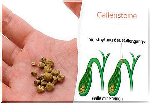 7 natural drinks for gallstones