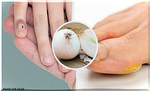 7 natural home remedies for calluses