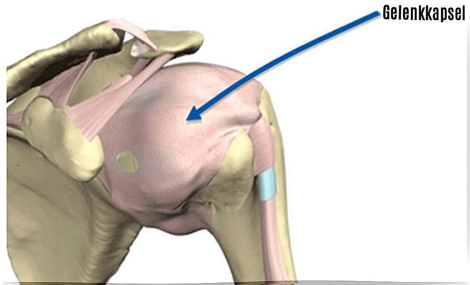 inflamed joint capsule in capsulitis