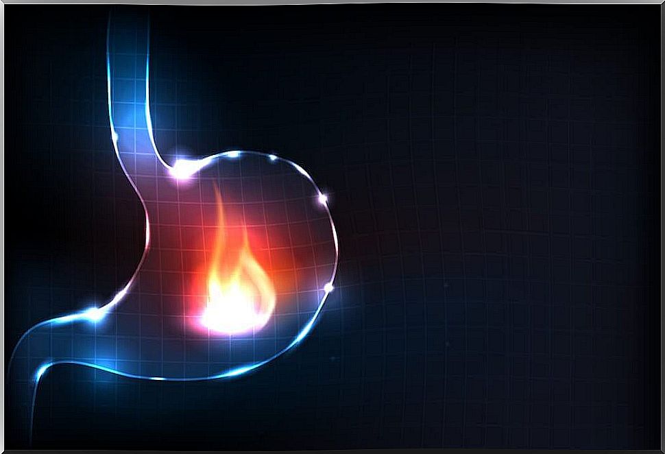 Establish healthy heartburn habits