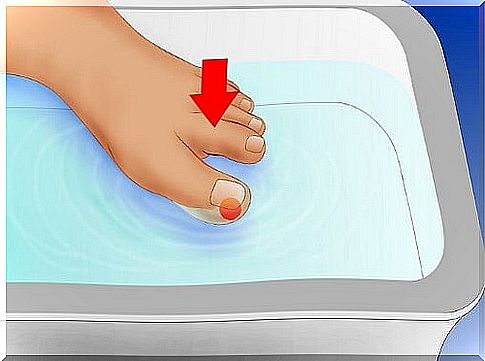 How are ingrown toenails treated?