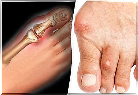 Study confirms that pomegranates can prevent gout