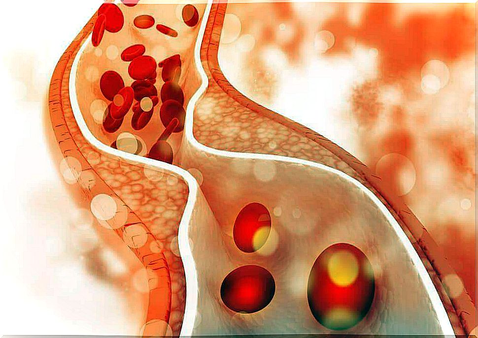 Everything you need to know about cholesterol and where to find it