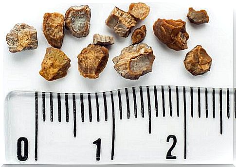 Prevention of kidney stones