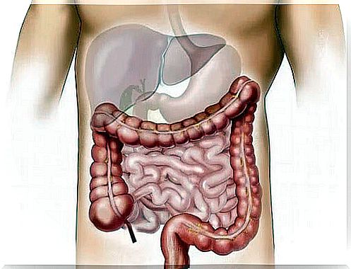 Diseases intestinal