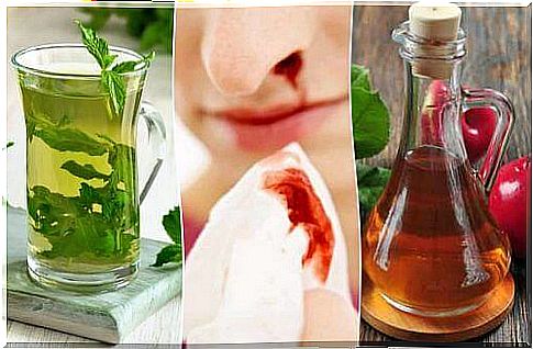 5 natural home remedies to stop nosebleeds