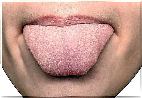 What diseases can our tongue reveal?